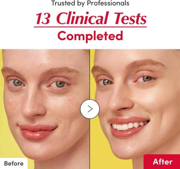 سيرم  EQQUAL BERRY الاصلي  لنضارة البشرة و علاج التجاعيد و الخطوط